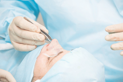 Ent-Surgery-Dr-Stephen-Kleid-Melbourne._1318764212