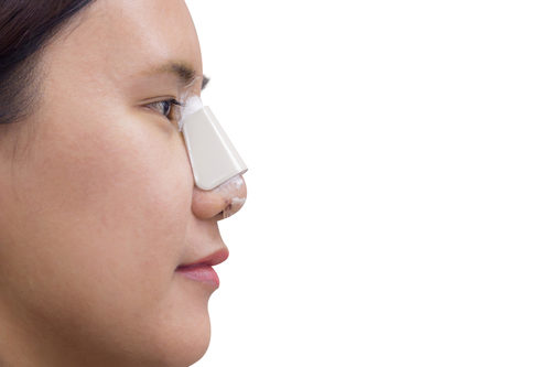 indian pakistani rhinoplasty Melbourne Dr Stepehn Kleid