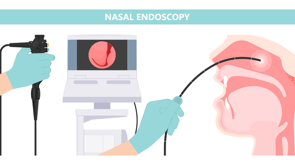 nasendoscopy